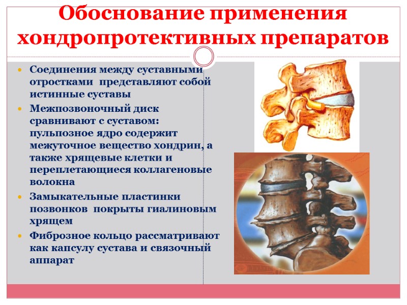 Обоснование применения хондропротективных препаратов Соединения между суставными отростками  представляют собой истинные суставы Межпозвоночный